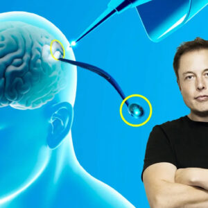 Elon Musk dice que Neuralink ya ha implantado un chip cerebral a un humano Se esta recuperando bien